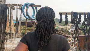 The struggle of living with HIV/AIDS in Cameroon